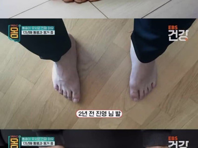 끼니마다 술과 고기를 먹는다는 30대 남자의 건강 상태