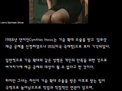 확대 수술 받고 국세청에 소송건 여자