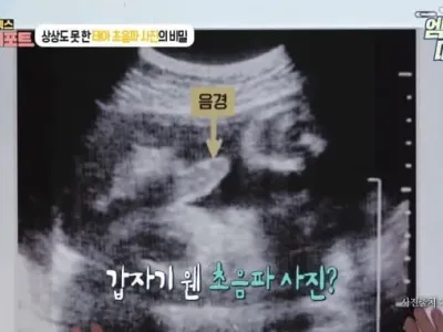 의외로 태아때부터 하는것.jpg