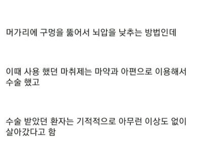 12000년전에 행해진 뇌수술 ㄷㄷ..jpg