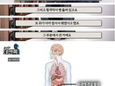 신해철 의료사고에 대해 말하는 부검의