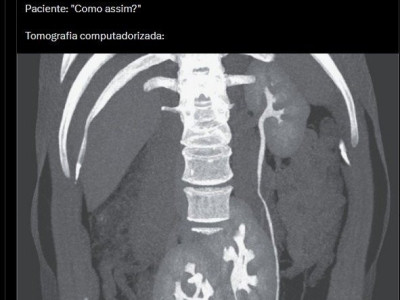 의사: "당신은 생물학적 복권에 당첨됐군요."  환자: "무슨 말씀이세요?"