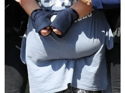 식탐 때문에 6살 입양딸을 살해한 양부모