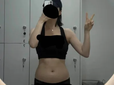 400만원 사용한 복부 지방흡입 전후 비교