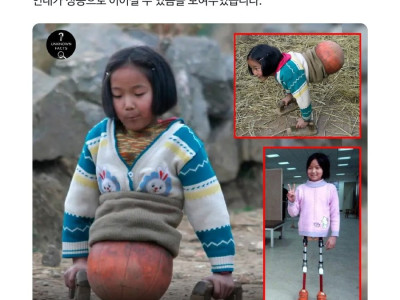 인간승리 그 자체를 보여주는 중국 농구공 소녀