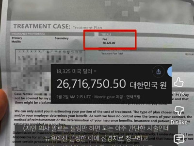 뉴욕 치과 치료비