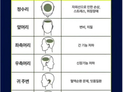 흰머리 나는 부위로 알수 있는 건강상태.jpg