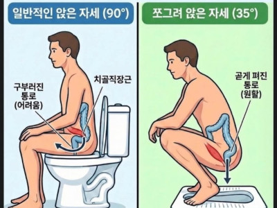 변비 안녕 괘변을 부르는 자세.jpg