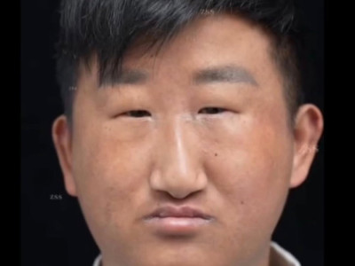 중국 성형 레전드 사진