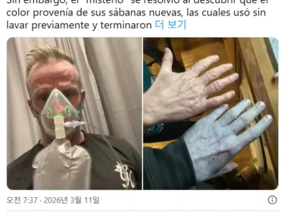 아침에 일어났는데 온몸이 파랗게 변한 영국 남성