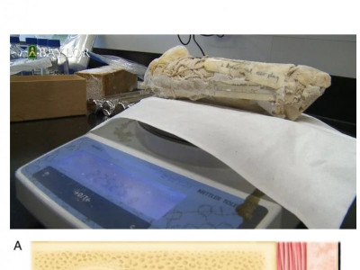 귀지로 알 수 있는 고래의 근황.jpg