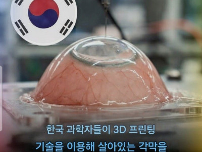 3D프린팅 각막으로 시력회복?