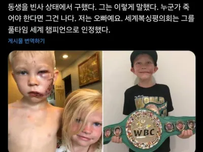 혐주의) 동생을 지키기 위해 개와 싸운 여섯살 소년
