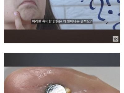동전 건전지 삼키면 위험한 이유