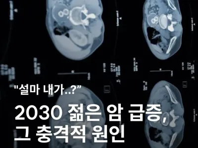 2030 젊은 암 급증, 그 충격적 원인