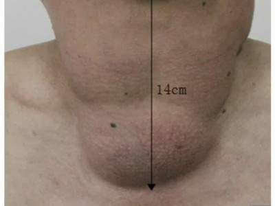 (약혐) 술을 물처럼 마시면 생기는 일