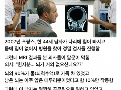 뇌빼기 레전드.jpg