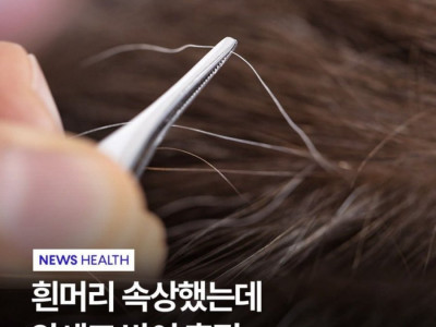 도쿄대에서 밝혀낸 흰머리의 비밀