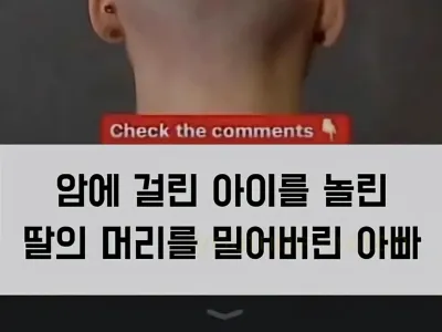 암에 걸린 아이를 놀린 딸의 머리를 밀어버린 아빠