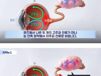 상상도 못한 국내 우울증 치료제 개발 근황