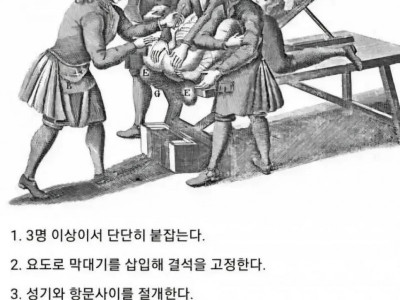 중세시대 요로결석 치료법