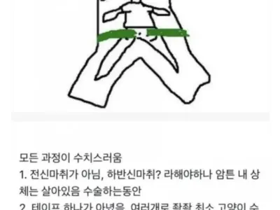 치질 수술의 위험성