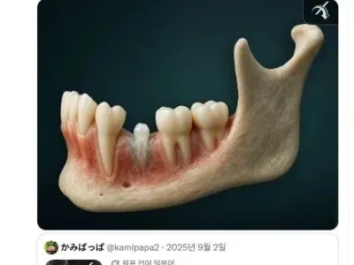전 세계를 충격에 빠트린 일본 치아재생 기술 근황.jpg