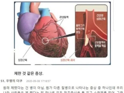 심근경색의 대표적인 전조증상.jpg