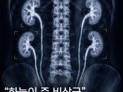 "하늘이 준 비상금(?)"