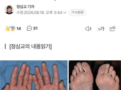 "콘돔으로도 못 막아" 전세계 난리
