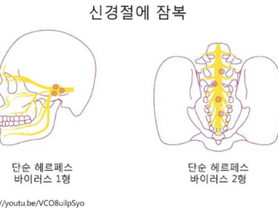 헤르페스가 완치가 불가능한 이유