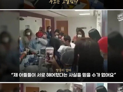 33시간 수술 끝에 서로 얼굴을 보게 된 쌍둥이