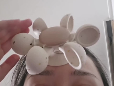 피해자가 속출하고 있는 제품