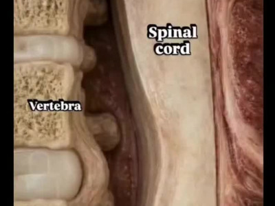 (약혐) 허리디스크가 터지는 장면