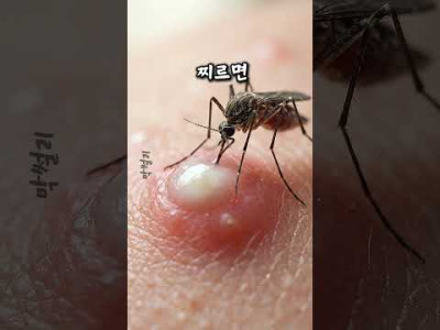 모기가 여드름을 물면 ㅎㄷㄷ